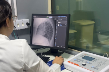 Novo Raio-X já está em funcionamento na SMS