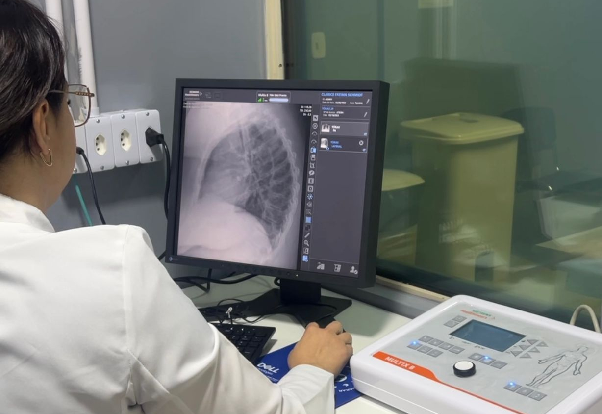 Novo Raio-X já está em funcionamento na SMS