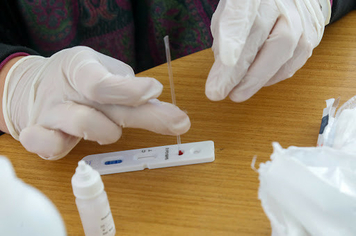 Esclarecimento - Vigilância Epidemiológica 